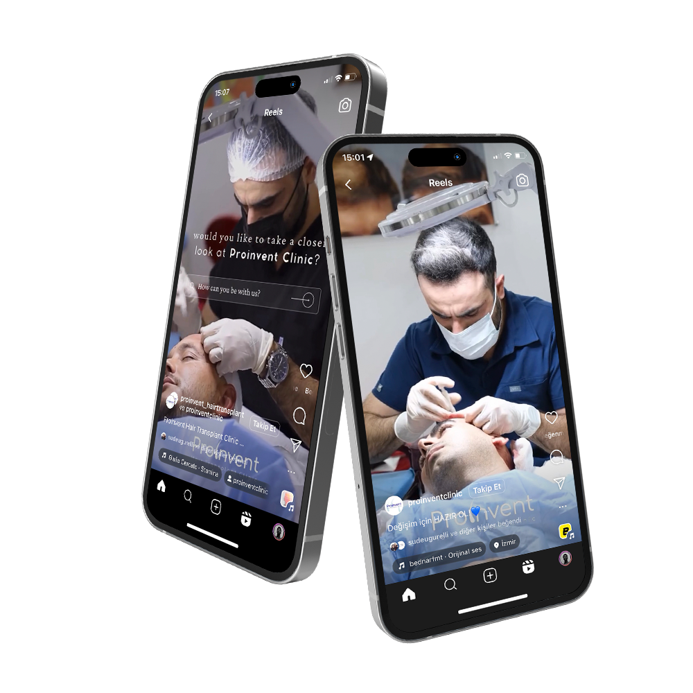 reels-story tasarımı